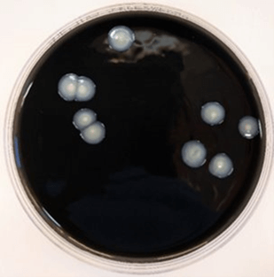colonies of legionella bacteria